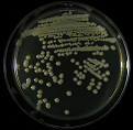Figure 4: Colony of Some pathogenic fungi and Antifungal spectrum of some drugs