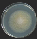 Figure 12: Colony of Some pathogenic fungi and Antifungal spectrum of some drugs
