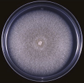 Figure 11: Colony of Some pathogenic fungi and Antifungal spectrum of some drugs