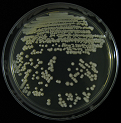 Figure 5: Colony of Some pathogenic fungi and Antifungal spectrum of some drugs