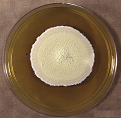 Figure 2: Colony of Some pathogenic fungi and Antifungal spectrum of some drugs