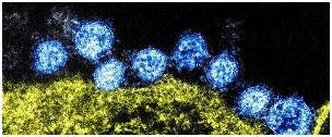 Figure 14: Common pathogenic viruses