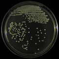Figure 8: Colony of Some pathogenic fungi and Antifungal spectrum of some drugs