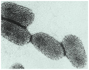Figure 7: Common pathogenic viruses