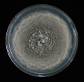 Figure 13: Colony of Some pathogenic fungi and Antifungal spectrum of some drugs