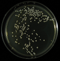 Figure 6: Colony of Some pathogenic fungi and Antifungal spectrum of some drugs