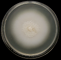 Figure 16: Colony of Some pathogenic fungi and Antifungal spectrum of some drugs